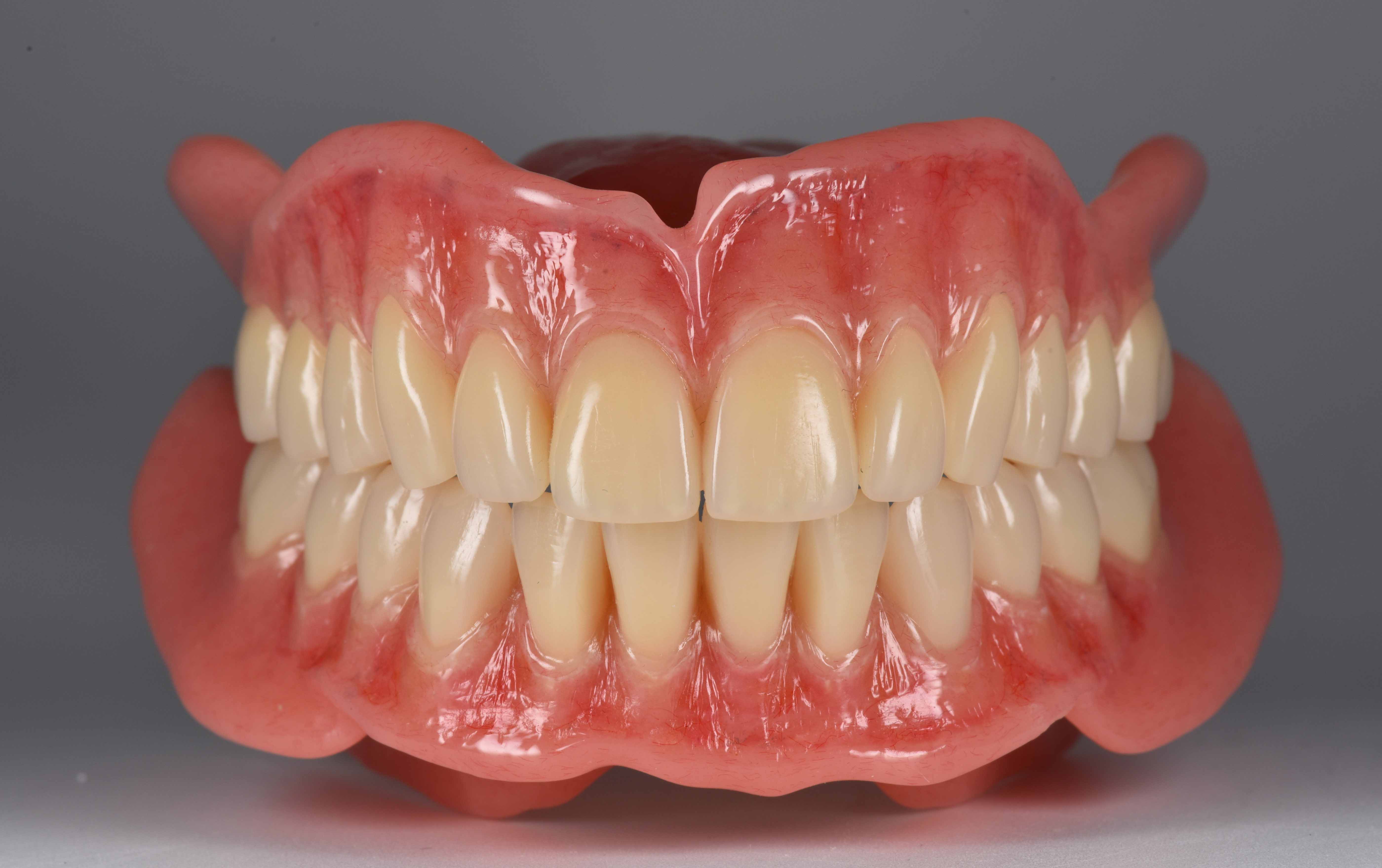 健康・医学 Best Denture Design Design high quality dentures using exocad by Dentcadsl | Fiverr